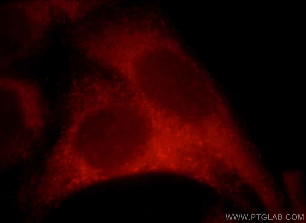 Sestrin 2 Polyclonal antibody