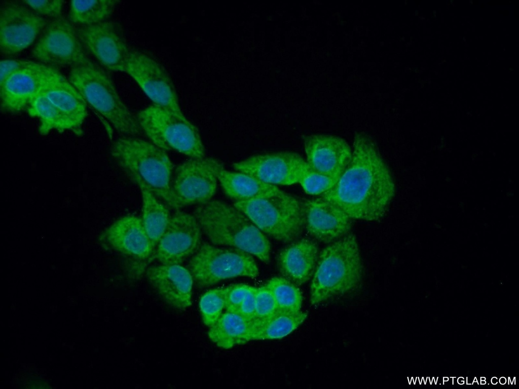 PLEKHO2 Polyclonal antibody