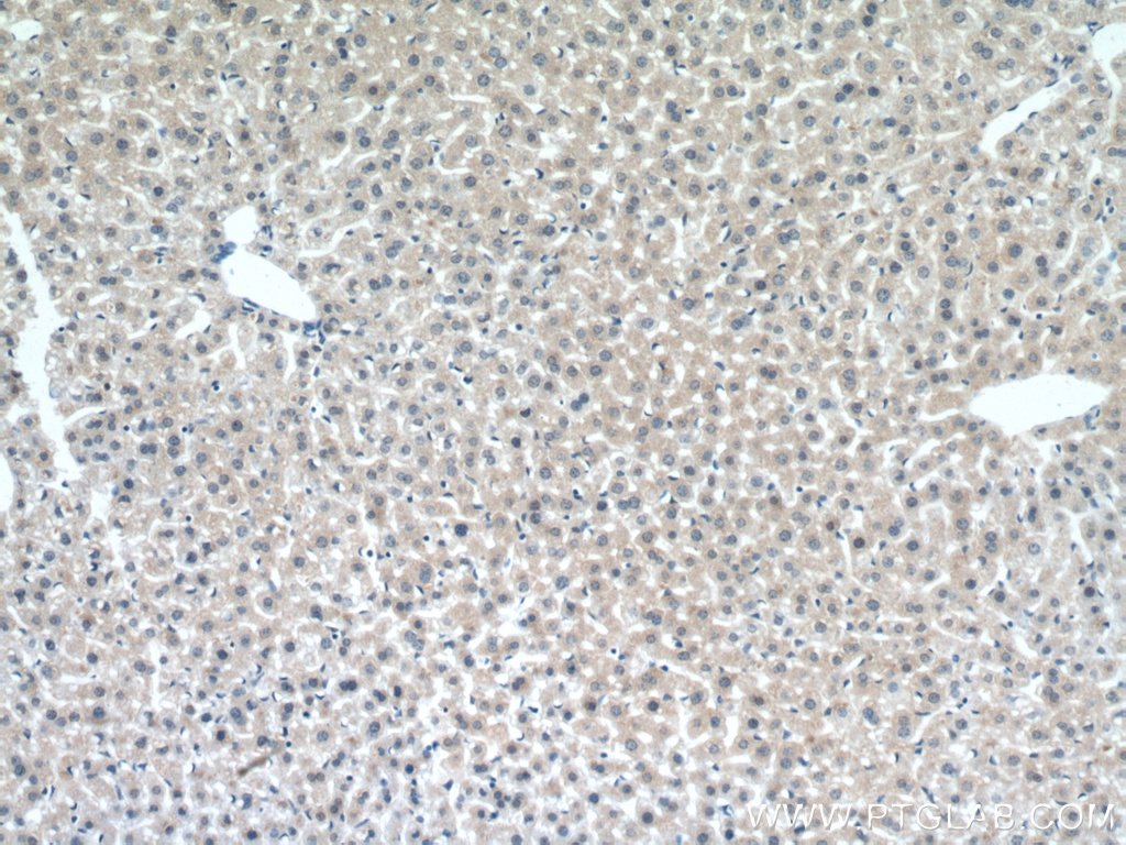 UGT3A2 Polyclonal antibody