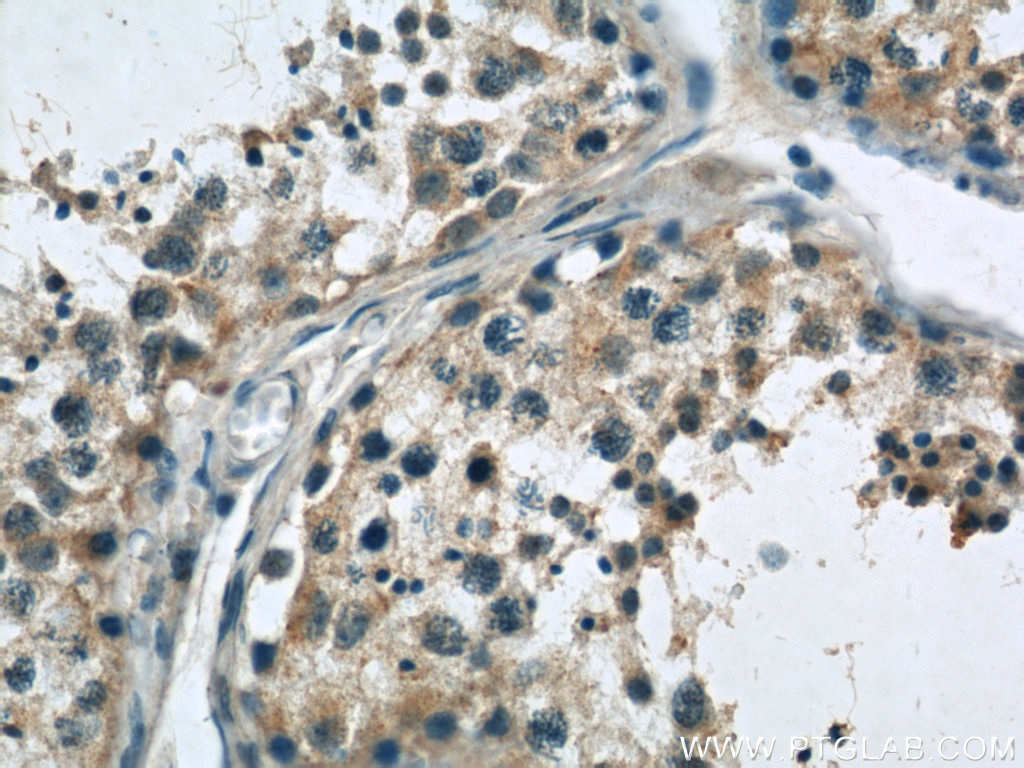 SASS6 Polyclonal antibody