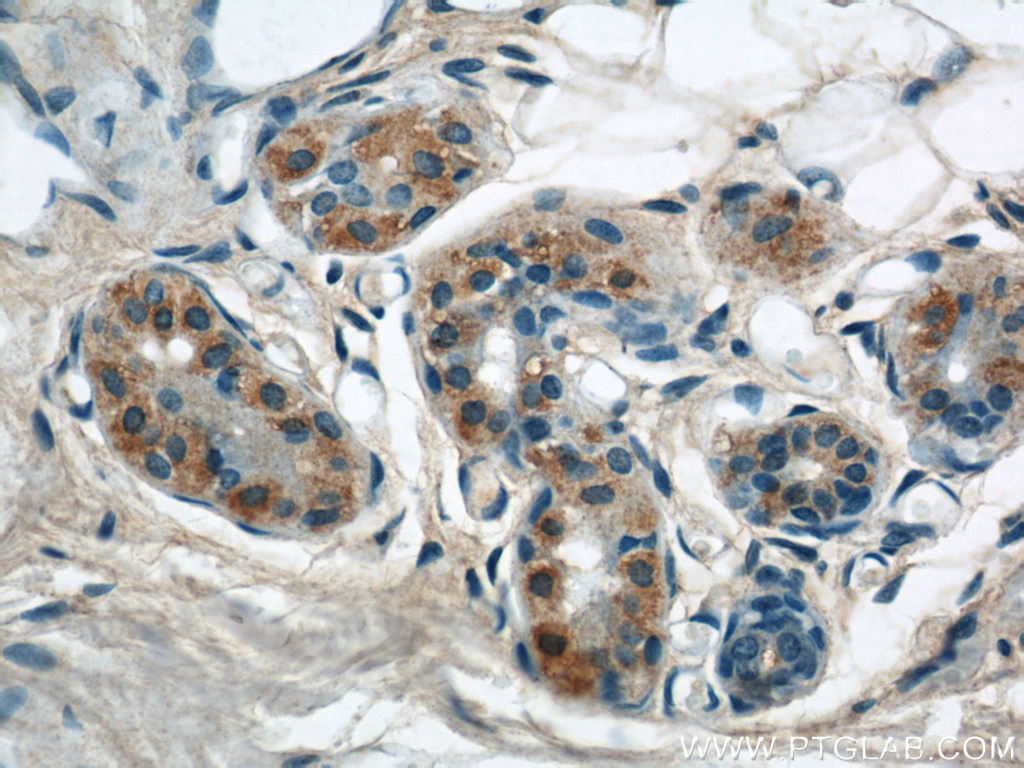 KIAA1602 Polyclonal antibody