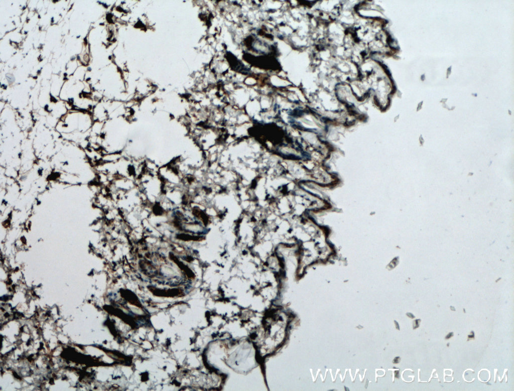 SGSM1 Polyclonal antibody