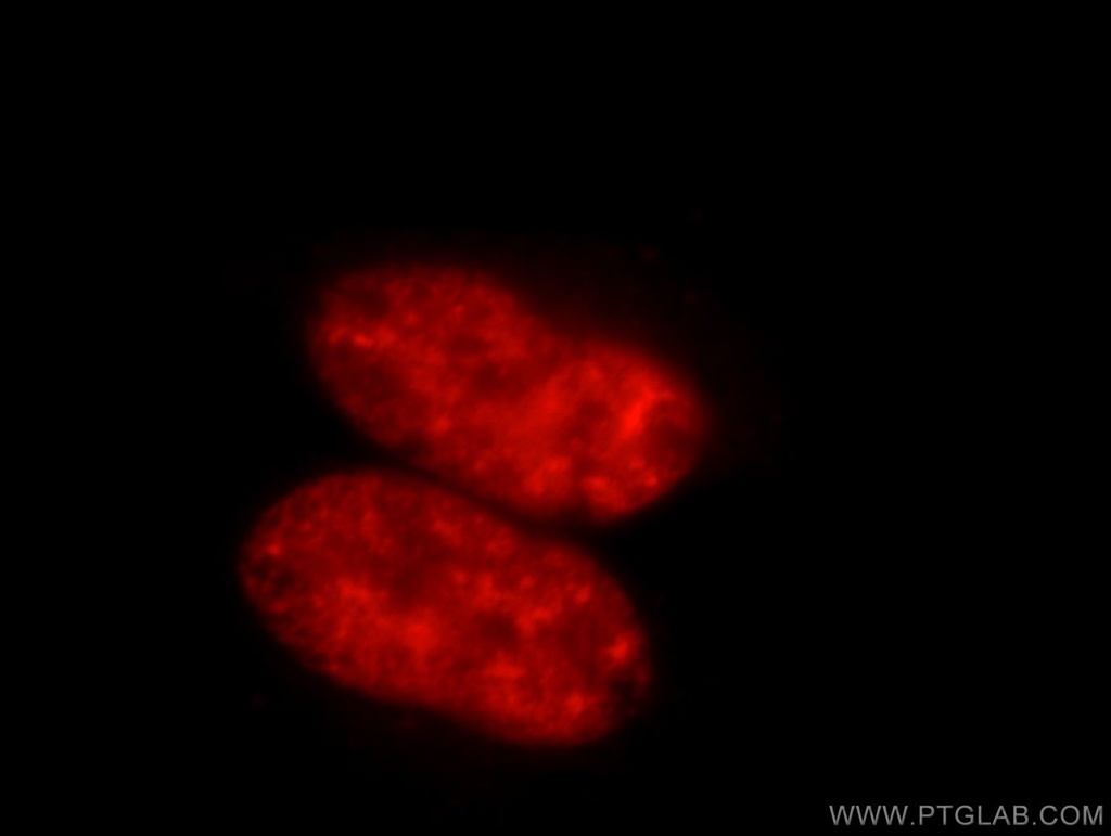 SR140 Polyclonal antibody