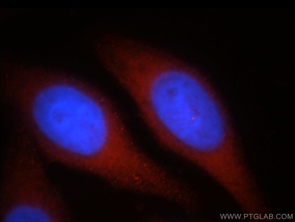SPATA13 Polyclonal antibody