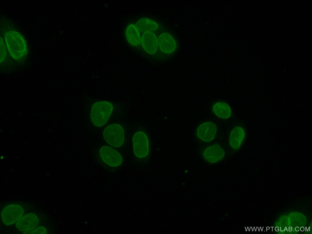 TOR1AIP1 Polyclonal antibody