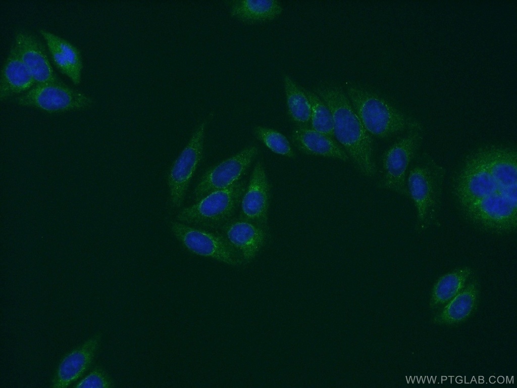 PRH1 Polyclonal antibody