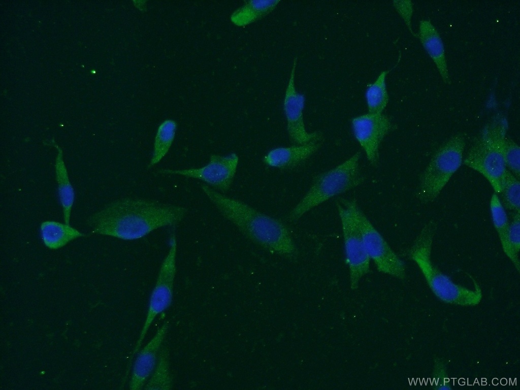 MAGEC3 Polyclonal antibody