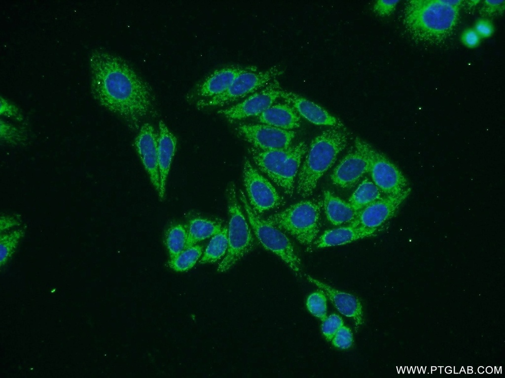 VANGL2 Polyclonal antibody