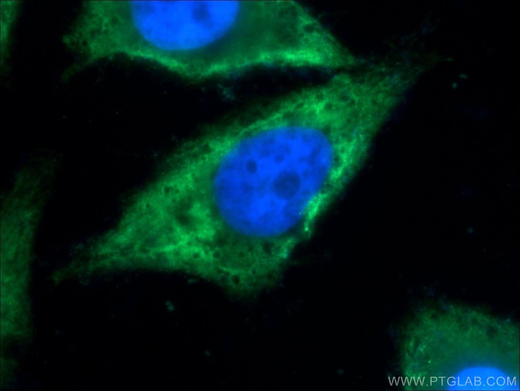 TXNDC16 Polyclonal antibody