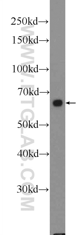 Frizzled 5 Polyclonal antibody