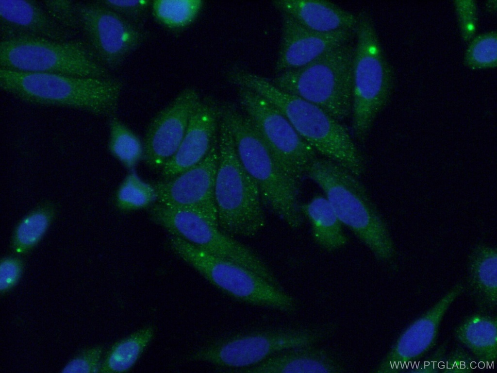 MYLK3 Polyclonal antibody