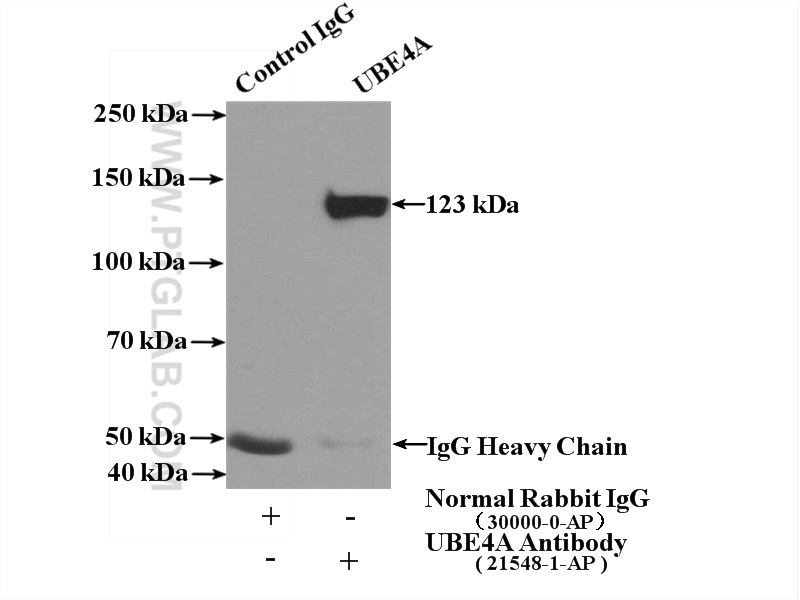 UBE4A Polyclonal antibody