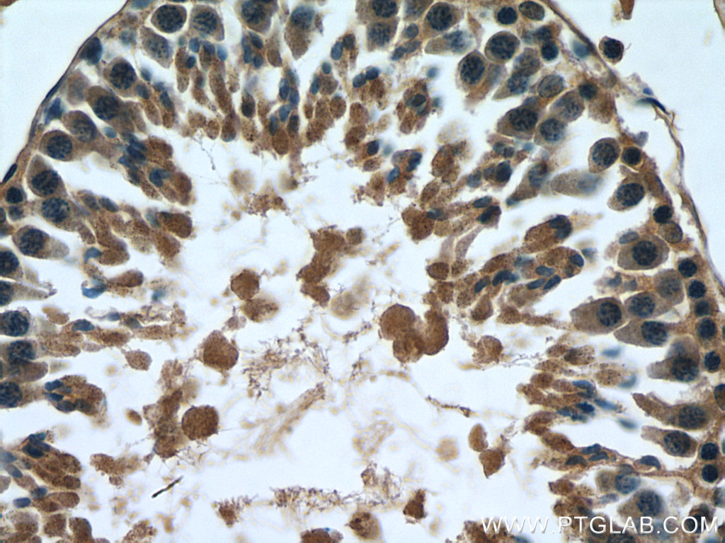 MARK1 Polyclonal antibody