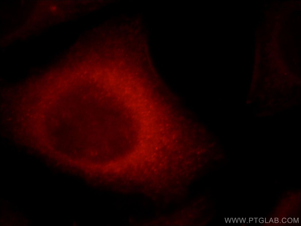 CYP26B1 Polyclonal antibody