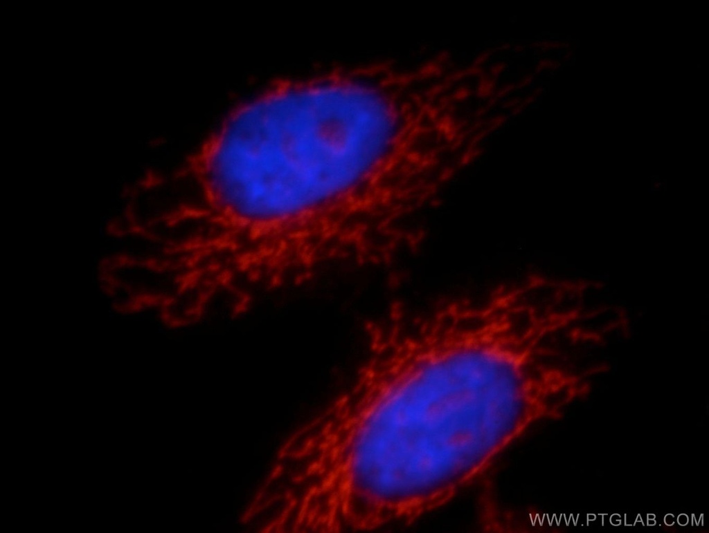 NAGS Polyclonal antibody
