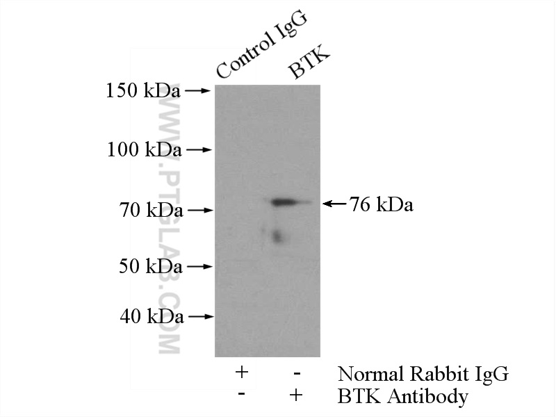 BTK Polyclonal antibody