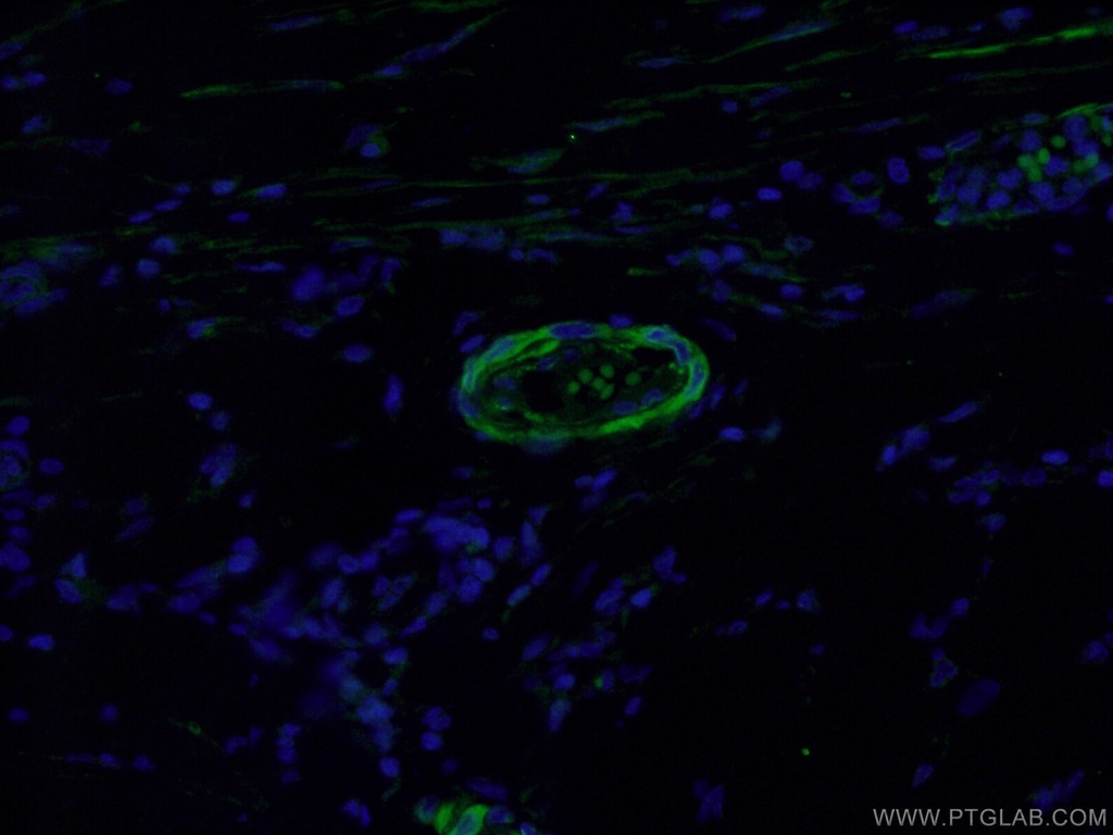 DLL4 Polyclonal antibody