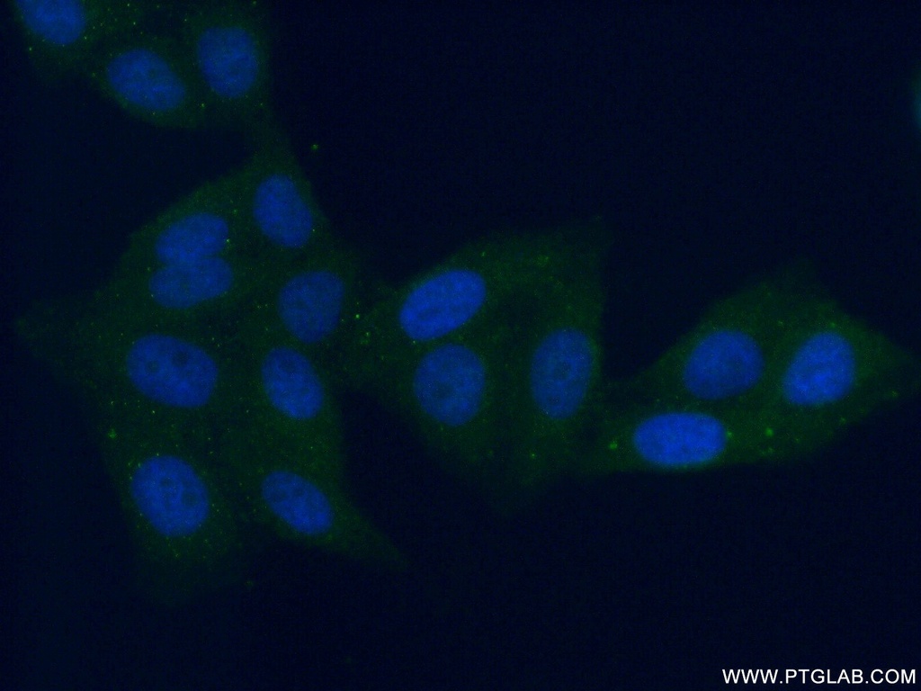 ALDH8A1 Polyclonal antibody