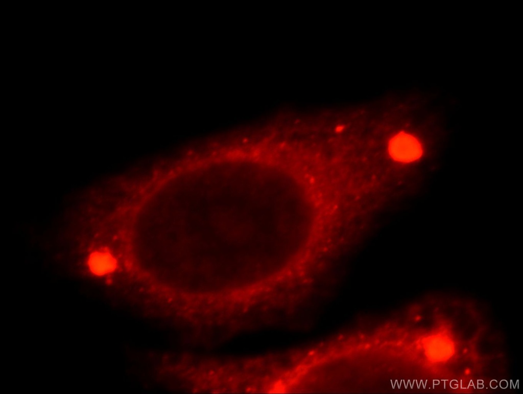TMED9 Polyclonal antibody