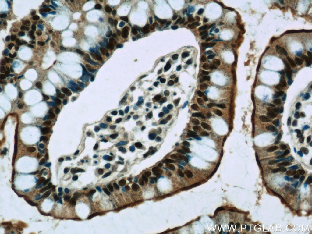 GPBP1 Polyclonal antibody