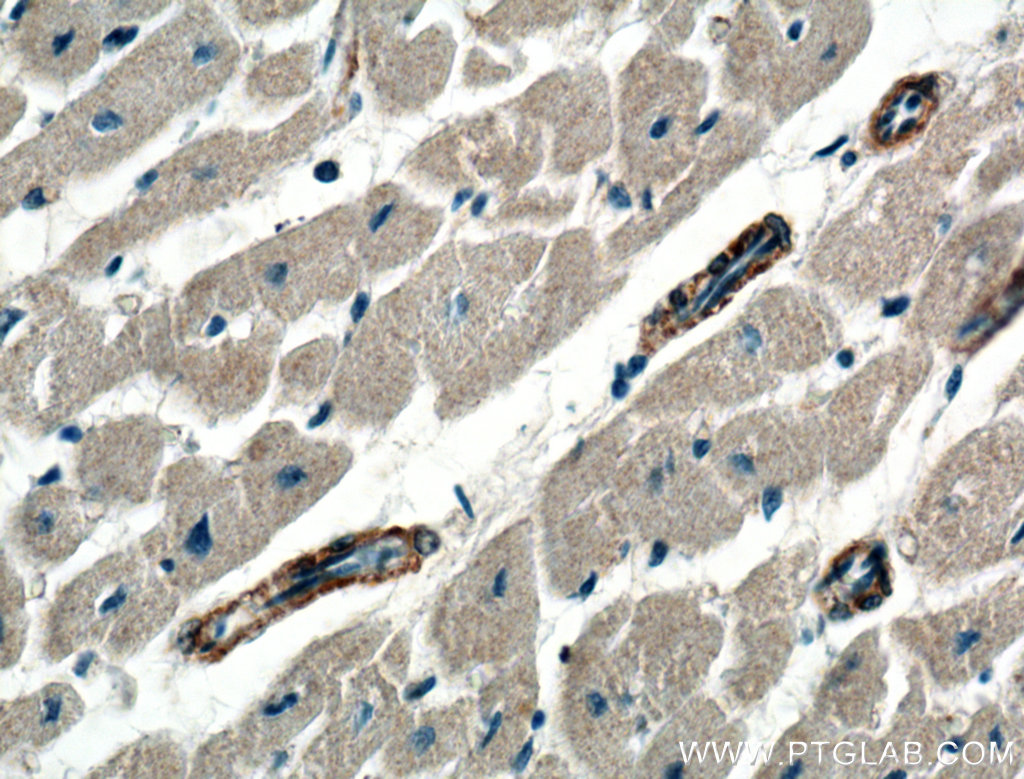 PRKG1 Polyclonal antibody