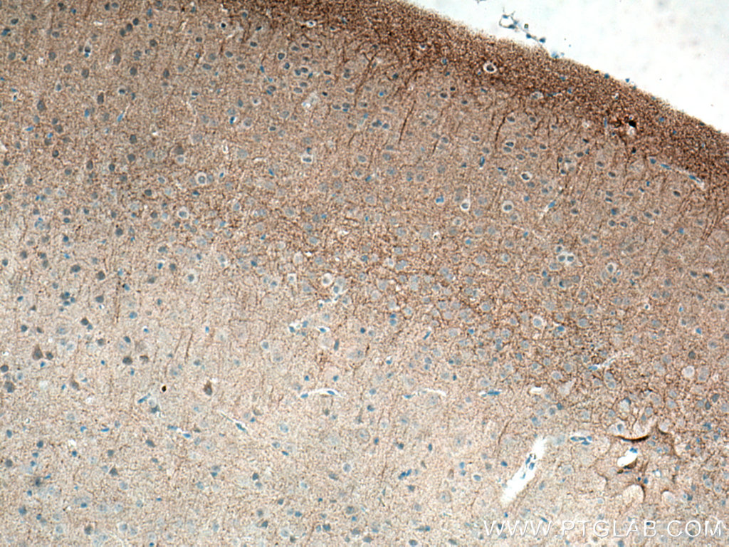 GIRK2 Polyclonal antibody