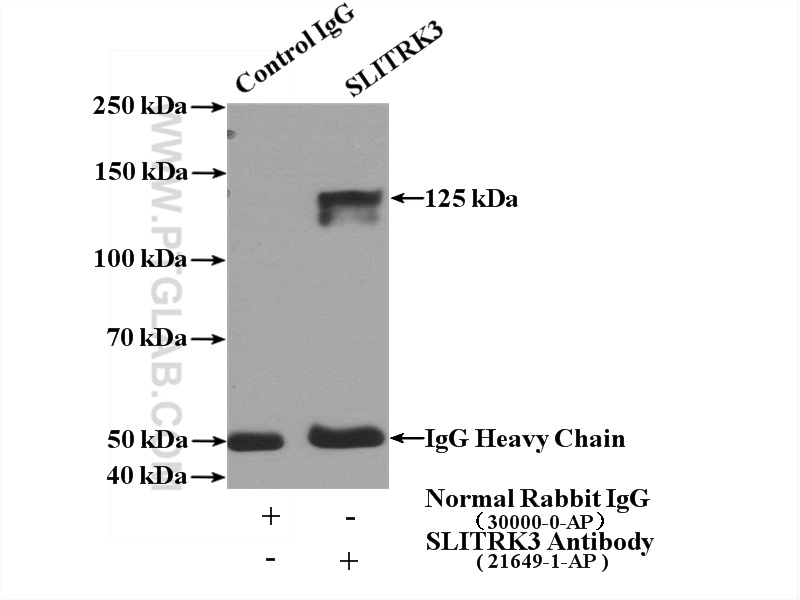 SLITRK3 Polyclonal antibody