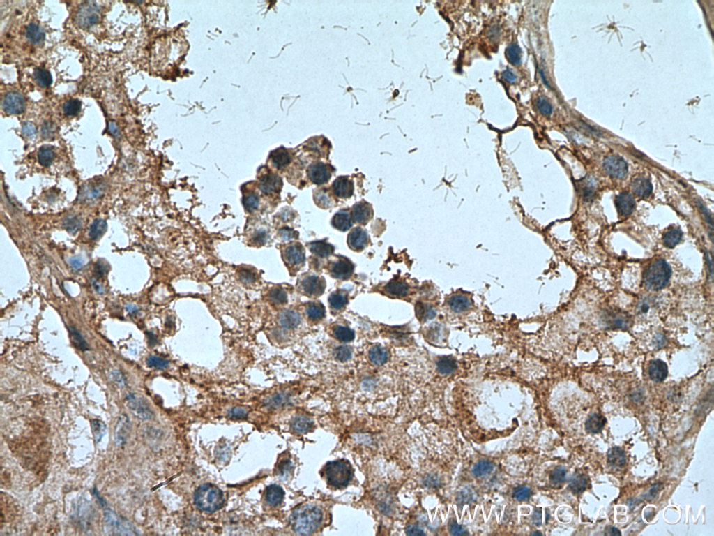 NANOS3 Polyclonal antibody