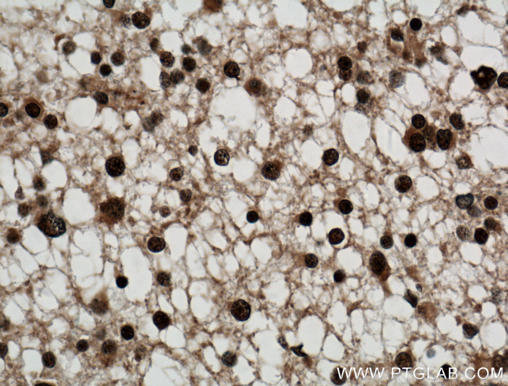 SMC1A Polyclonal antibody