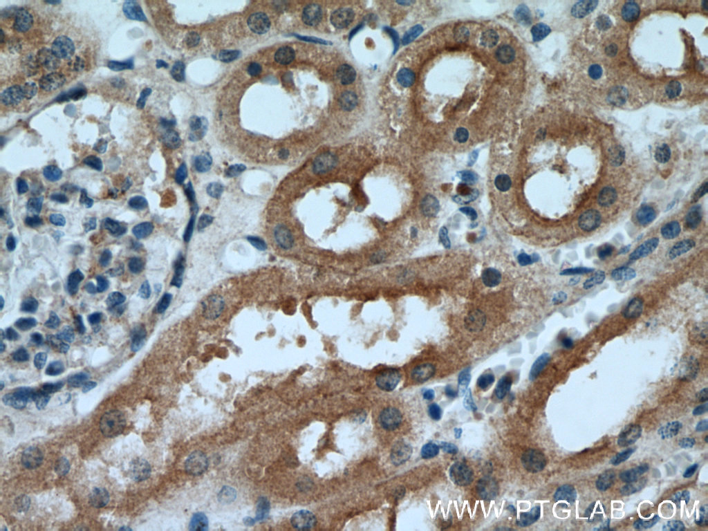 IDE Polyclonal antibody