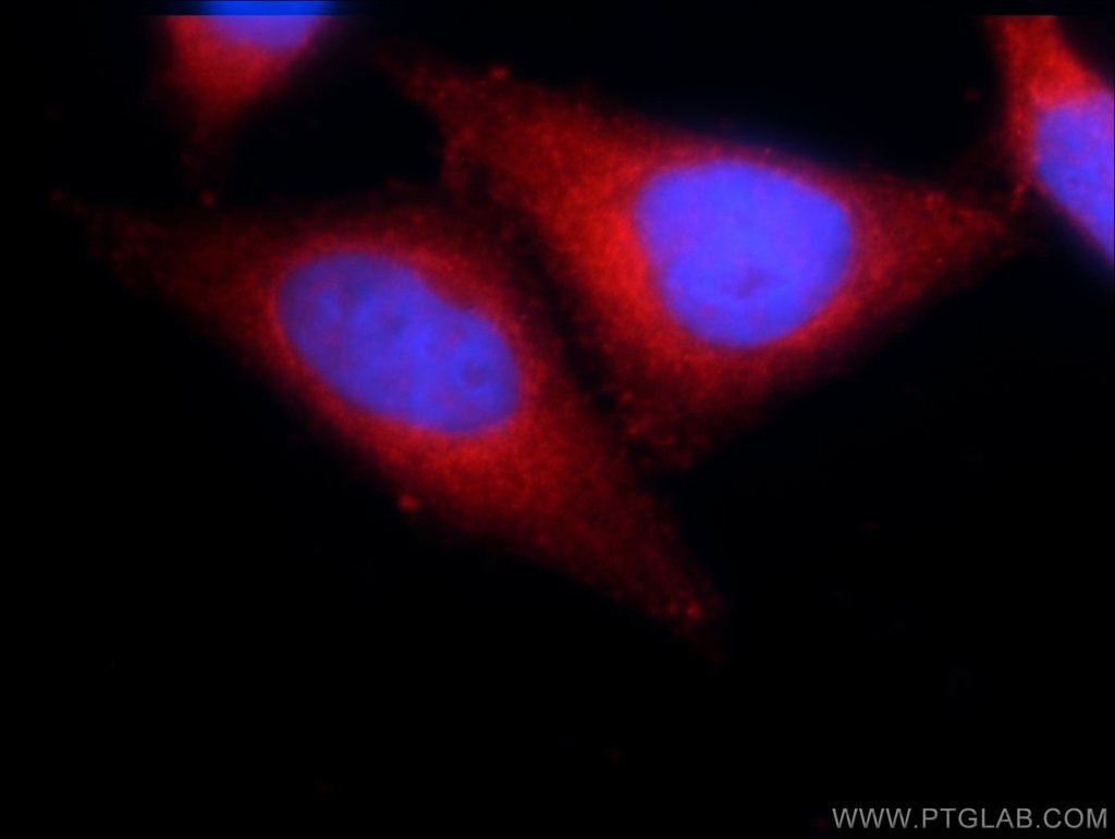 CARD11 Polyclonal antibody
