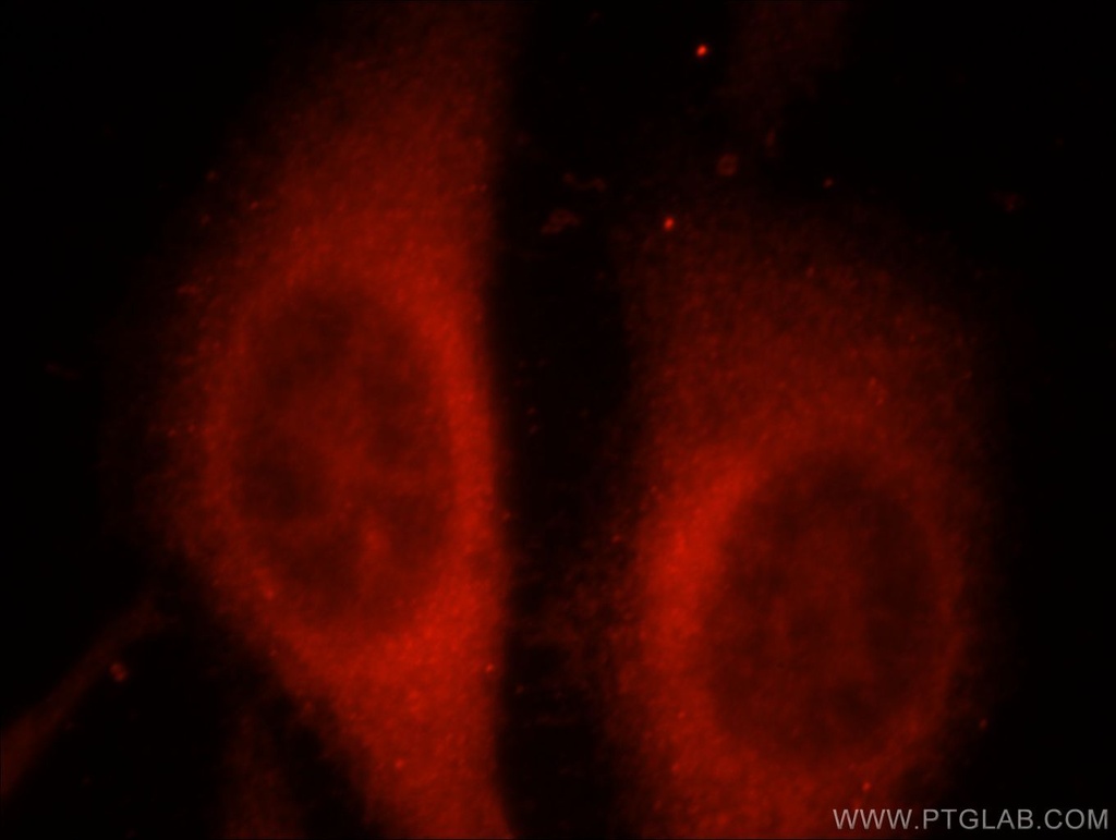 RAPGEFL1 Polyclonal antibody