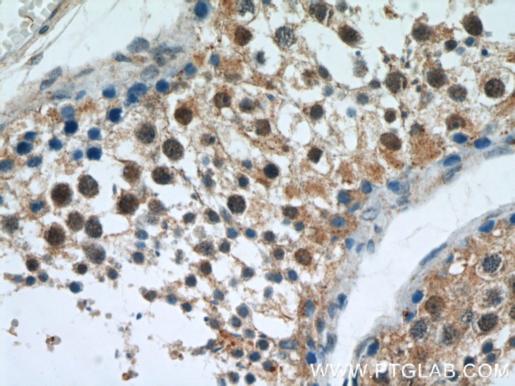 APC1 Polyclonal antibody