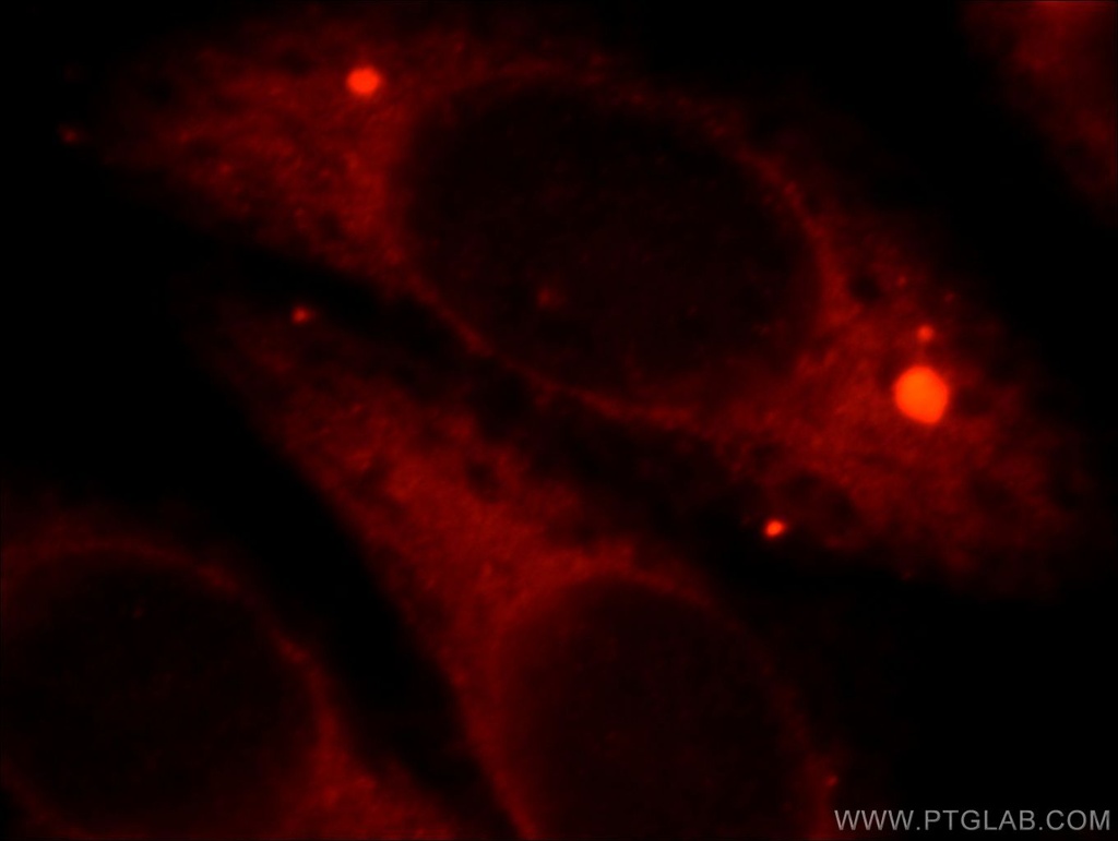 HSPB2 Polyclonal antibody