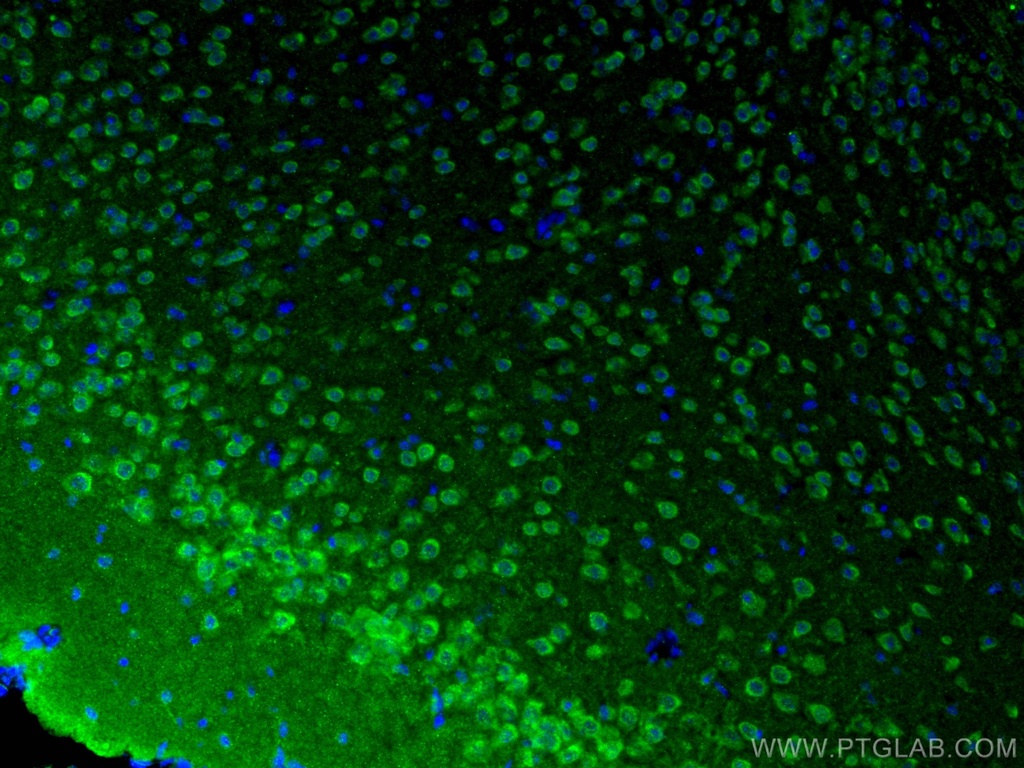 L-VOCC Polyclonal antibody