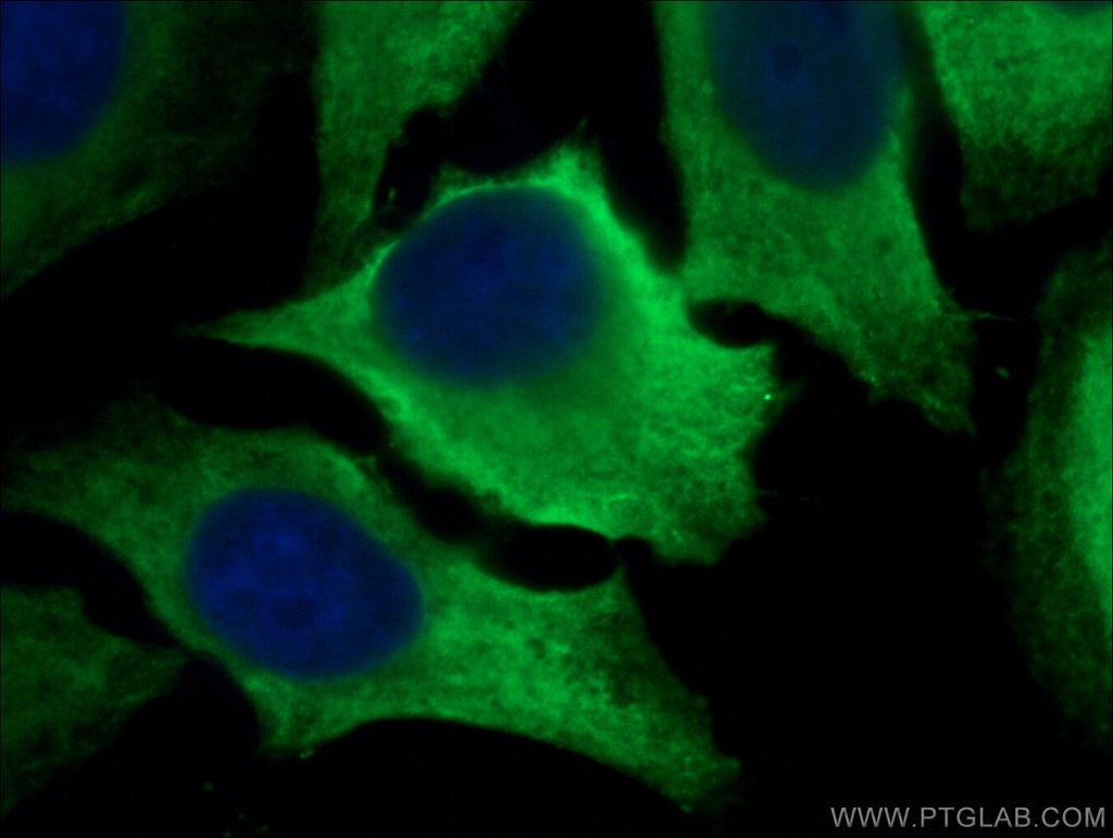 LDHA Polyclonal antibody