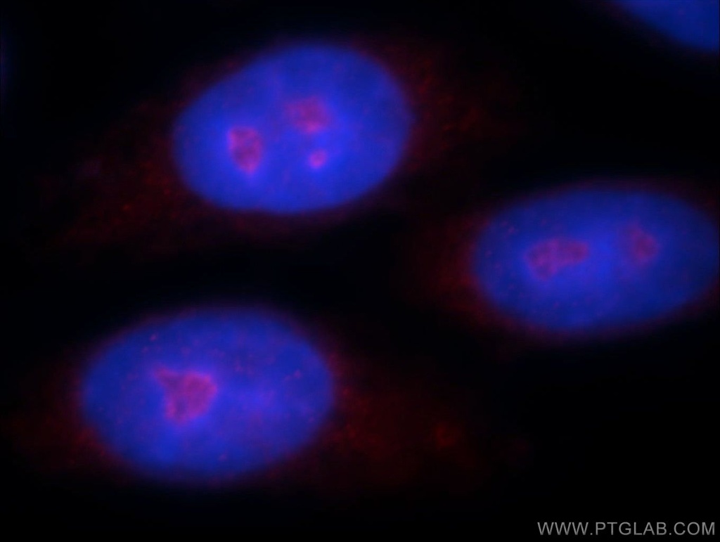 ZNF74 Polyclonal antibody
