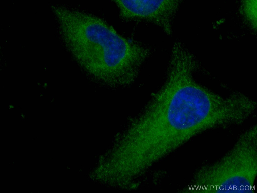 ROCK1 Polyclonal antibody
