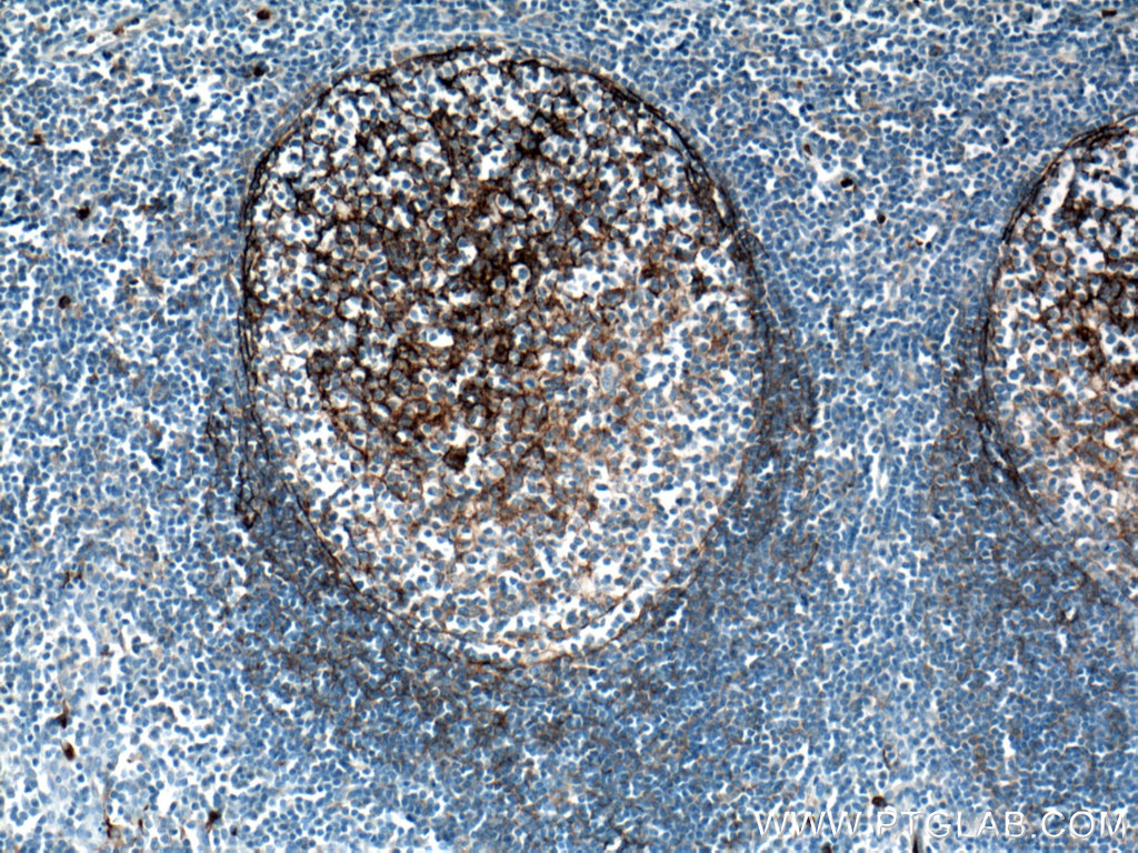 CD11B/Integrin Alpha M Polyclonal antibody