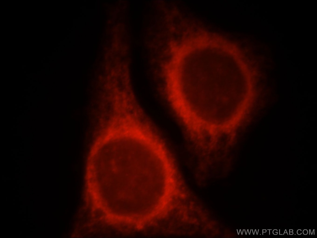 NR3C2 Polyclonal antibody