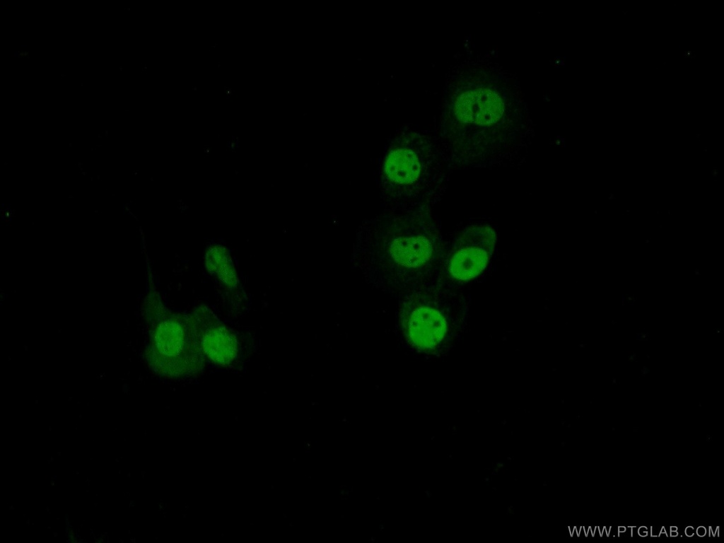 SAFB Polyclonal antibody