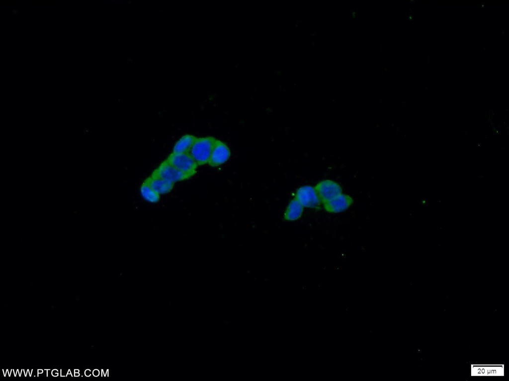 CCHCR1 Polyclonal antibody