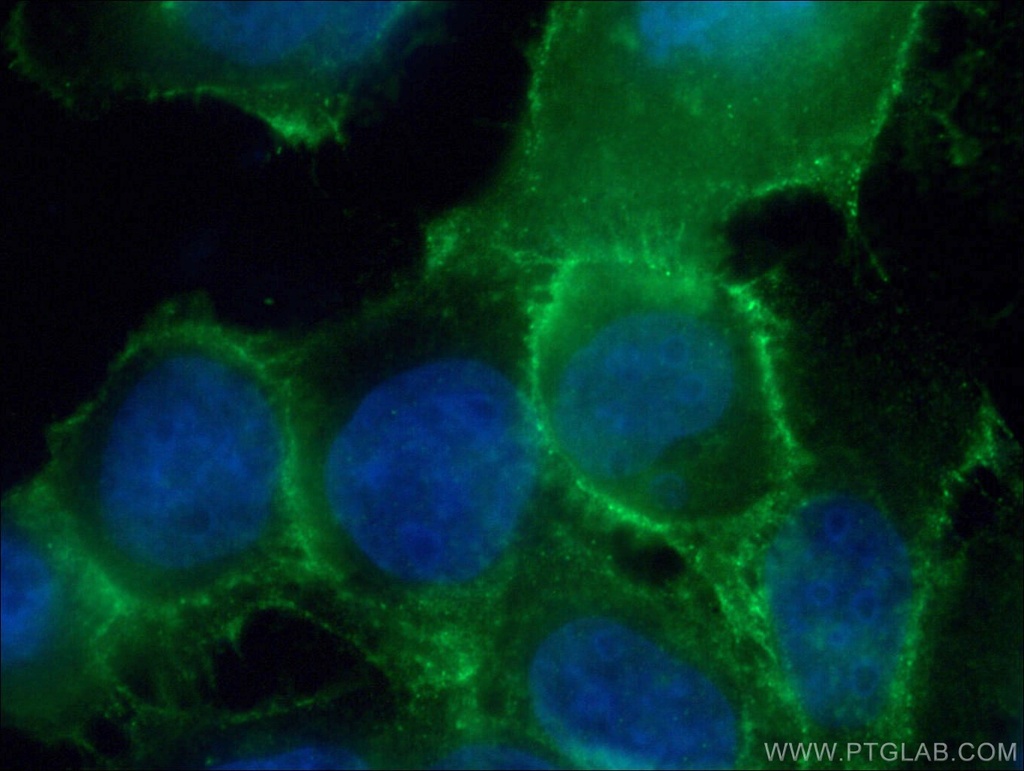 DSG2 Polyclonal antibody