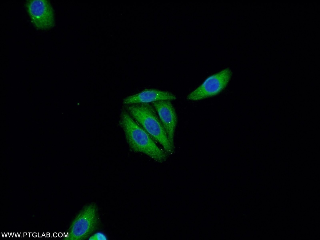 P53 Polyclonal antibody