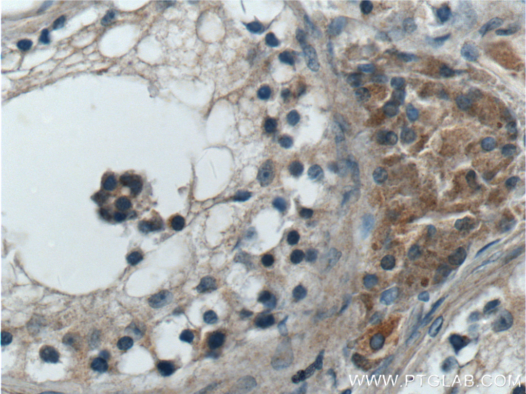 ANO10 Polyclonal antibody