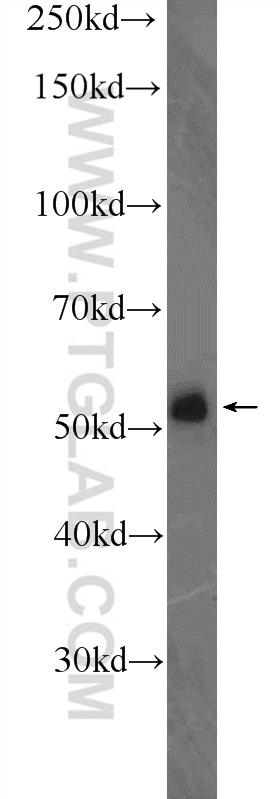 DELE1 Polyclonal antibody