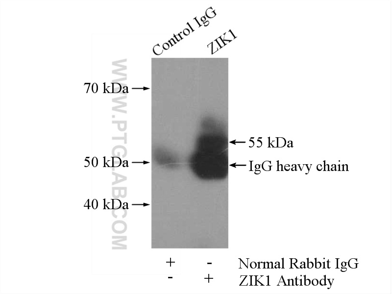 ZIK1 Polyclonal antibody