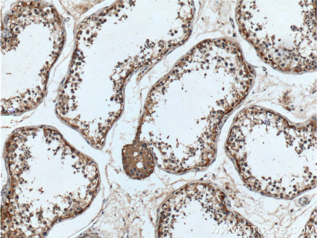 UCN Polyclonal antibody