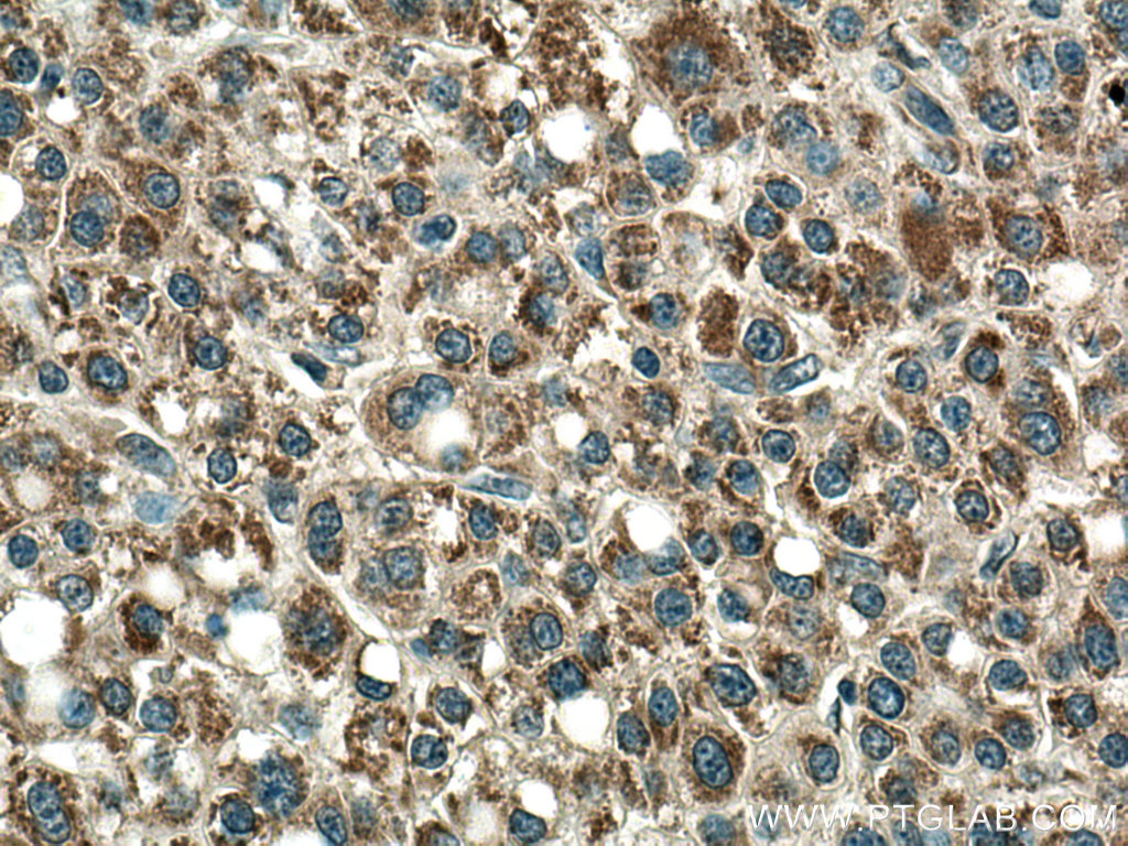 PCCA Polyclonal antibody