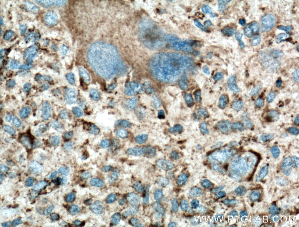 LAMP1 Polyclonal antibody